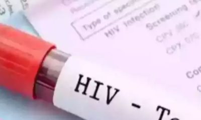 HIV