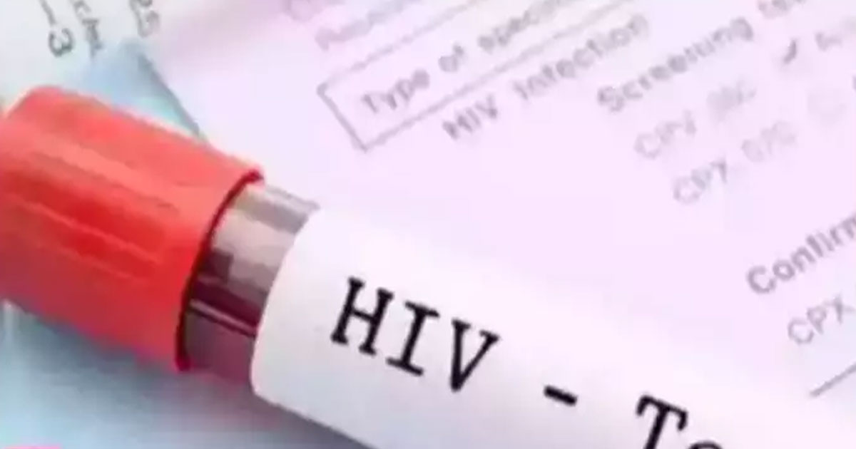 HIV