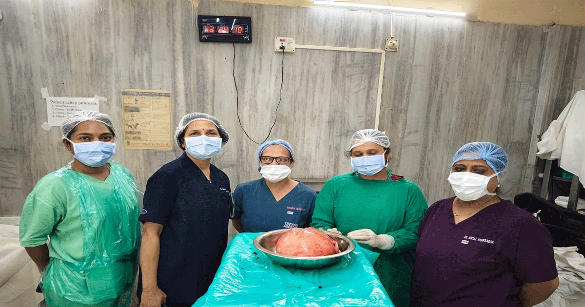 30-cm-tumor